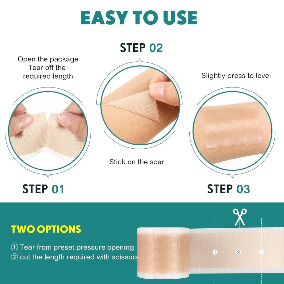 Derma Silicone Tape – Fast & Painless Scar Removal Solution At Home - Blushbae