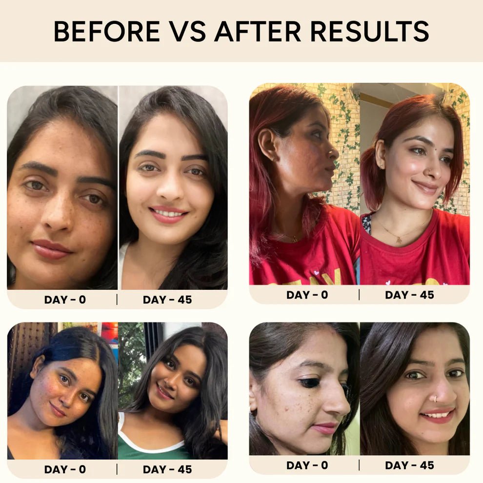 Invisible Korean Collagen Melting Patches - Get Radiant Glass Skin in One Use! - Blushbae